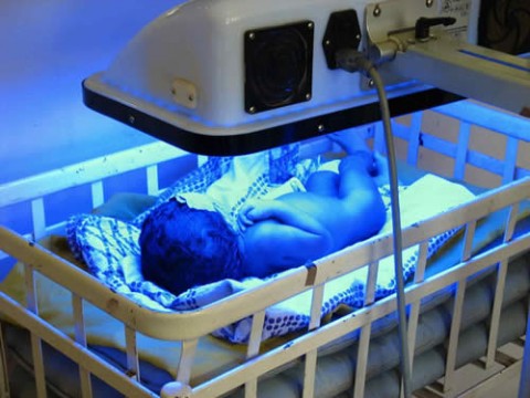 Newborn Phototherapy and Cancer: Cutting Edge Research or “Big Data” Failure?