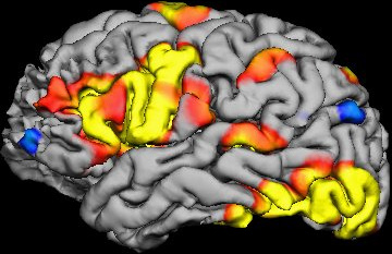 New Study Questions fMRI Validity