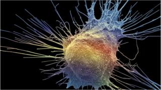 Prostate cancer treatment ‘could help more patients’