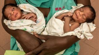 Twins in sub-Saharan Africa ‘more likely to die’ in early childhood